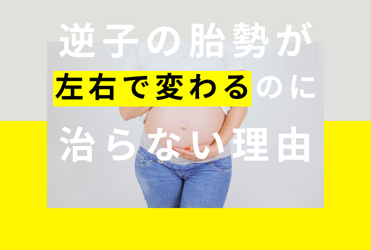 逆子の胎勢が左右で変わるのに治らない理由